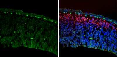 Immunohistochemistry-Frozen: IGFBP-3 Antibody [NBP2-16933]