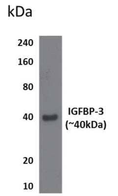 Western Blot: IGFBP-3 Antibody (RM0096-11B16)Azide and BSA Free [NBP1-22452]