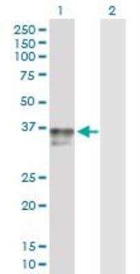 Western Blot: IGFBP-3 Antibody [H00003486-D01P]