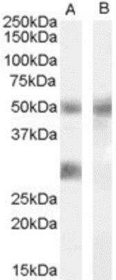 Western Blot: IGFBP-3 Antibody [NBP1-00203]