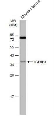 Western Blot: IGFBP-3 Antibody [NBP2-16933]