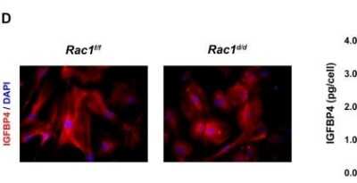 Immunocytochemistry/ Immunofluorescence: IGFBP-4 Antibody [NBP1-80549]