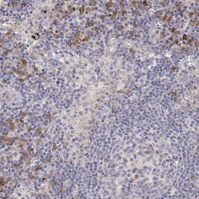 Immunohistochemistry: IGFBP-4 Antibody [NBP2-38086]