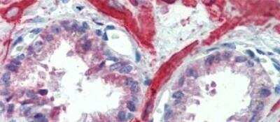 Immunohistochemistry-Paraffin: IGFBP-4 Antibody [NBP1-80549]