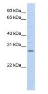 Western Blot: IGFBP-4 Antibody [NBP1-80549]