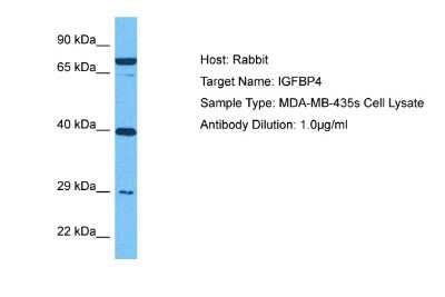Western Blot: IGFBP-4 Antibody [NBP1-80549]