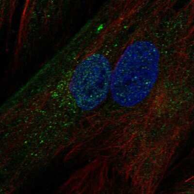 Immunocytochemistry/ Immunofluorescence: IGFBP-5 Antibody [NBP2-68755]