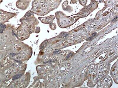 Immunohistochemistry-Paraffin: IGFBP-5 Antibody (MM0344-8D21) - Azide and BSA Free [NBP2-12366]