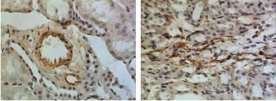 Immunohistochemistry-Paraffin: IGFBP-5 Antibody (RM0097-12C23) - Azide and BSA Free [NBP1-22453]