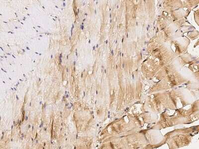 Immunohistochemistry-Paraffin: IGFBP-6 Antibody (104) [NBP2-90597]