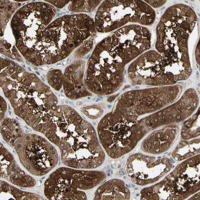 Immunohistochemistry-Paraffin: IGFBP-6 Antibody [NBP1-86495]