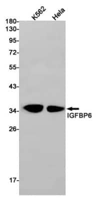 Western Blot: IGFBP-6 Antibody (S02-6G2) [NBP3-14896]