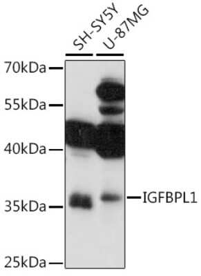 Western Blot: IGFBP-L1 AntibodyAzide and BSA Free [NBP3-15487]