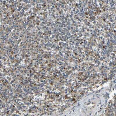 Immunohistochemistry-Paraffin: IGFBP-rP10/KAZALD1 Antibody [NBP1-90453]