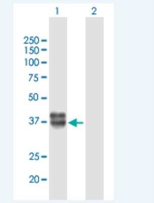 Western Blot: IGFBP-rP10/KAZALD1 Antibody [H00081621-B01P-50ug]