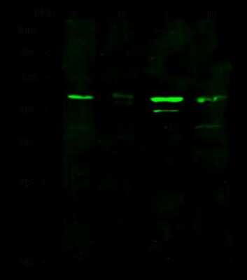 Western Blot: IGFBP-rP10/KAZALD1 Antibody [NBP2-98914]