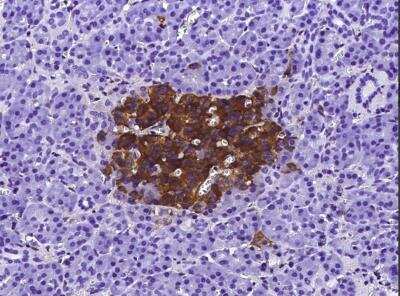 Immunohistochemistry-Paraffin: IGFBP-rp1/IGFBP-7 Antibody (115) [NBP2-90176]