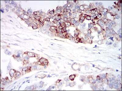 Immunohistochemistry-Paraffin: IGFBP-rp1/IGFBP-7 Antibody (1D9E7) - BSA Free [NBP2-37313]