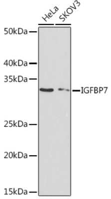 Western Blot: IGFBP-rp1/IGFBP-7 Antibody (8M10Q9) [NBP3-16449]