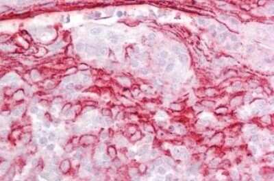 Immunohistochemistry-Paraffin: IGFBP-rp1/IGFBP-7 Antibody [NB100-94904]