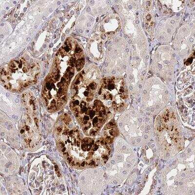 Immunohistochemistry-Paraffin: IGFBP-rp1/IGFBP-7 Antibody [NBP1-83415]