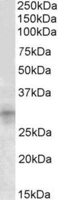 Western Blot: IGFBP-rp1/IGFBP-7 Antibody [NBP1-49861]