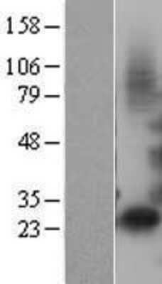 Western Blot: IGFBP-1 Overexpression Lysate [NBL1-11873]