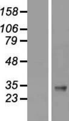 Western Blot: IGFBP-3 Overexpression Lysate [NBP2-08719]