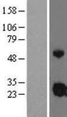 Western Blot: IGFBP-4 Overexpression Lysate [NBL1-11874]