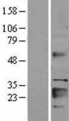 Western Blot: IGFBP-6 Overexpression Lysate [NBL1-11876]