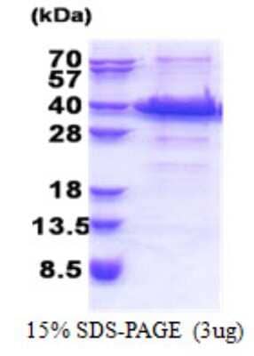 SDS-PAGE: Recombinant Human IGFBP-rp1/IGFBP-7 His Protein [NBP2-23142]