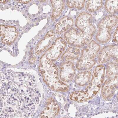 Immunohistochemistry: IGFL-3 Antibody [NBP2-38004]