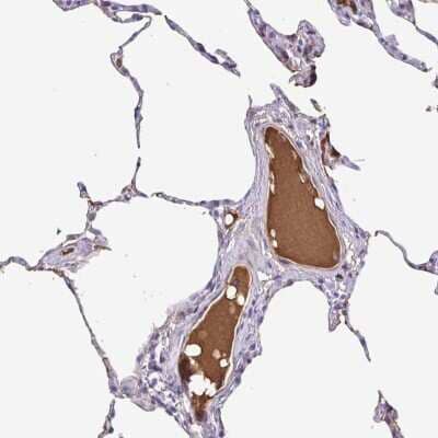 Immunohistochemistry: IGFL1 Antibody [NBP2-33869]