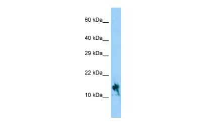 Western Blot: IGFL1 Antibody [NBP2-83074]