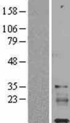 Western Blot: IGFL1 Overexpression Lysate [NBL1-11877]