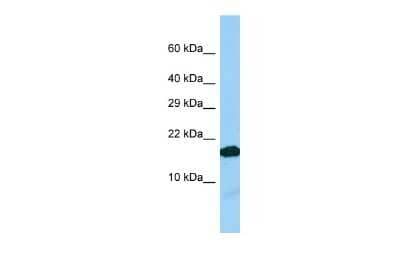 Western Blot: IGFL2 Antibody [NBP3-09570]