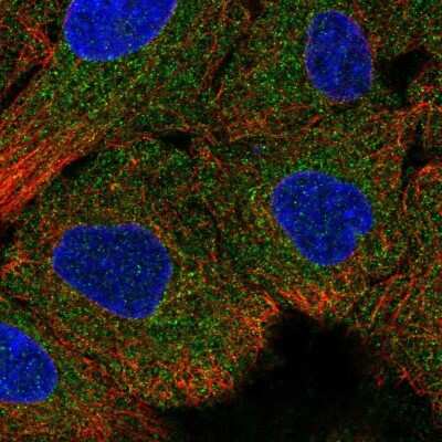 Immunocytochemistry/ Immunofluorescence: IGFL4 Antibody [NBP2-14603]