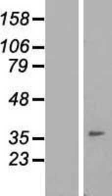 Western Blot: IGFLR1/TMEM149 Overexpression Lysate [NBP2-06309]