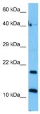 Western Blot: IGH-VJ558 Antibody [NBP3-10176]