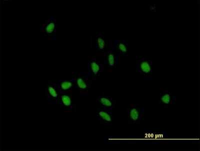 Immunocytochemistry/ Immunofluorescence: IgA2 Antibody [H00003494-B01P]