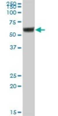 Western Blot: IgA2 Antibody [H00003494-B01P]