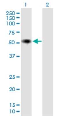 Western Blot: IgA2 Antibody [H00003494-B01P]