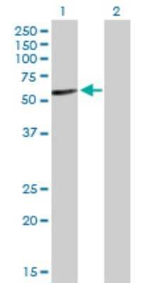 Western Blot: IgA2 Antibody [H00003494-D01P]