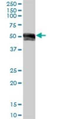 Western Blot: IGHG1 Antibody [H00003500-B01P]