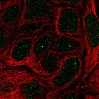 Immunocytochemistry/ Immunofluorescence: IGHMBP2 Antibody [NBP2-57526]