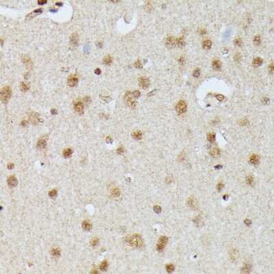 Immunohistochemistry-Paraffin: IGHMBP2 Antibody - Azide and BSA Free [NBP3-05096]