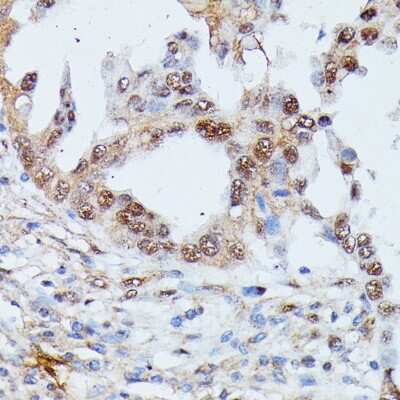Immunohistochemistry-Paraffin: IGHMBP2 Antibody - Azide and BSA Free [NBP3-05096]