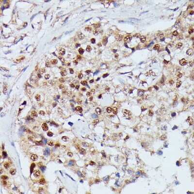 Immunohistochemistry-Paraffin: IGHMBP2 Antibody - Azide and BSA Free [NBP3-05096]