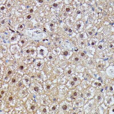 Immunohistochemistry-Paraffin: IGHMBP2 Antibody - Azide and BSA Free [NBP3-05096]
