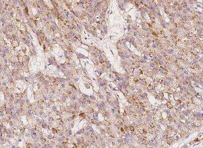 Immunohistochemistry-Paraffin: IGHMBP2 Antibody [NBP3-06533]